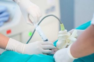 sinh thiết gai nhau