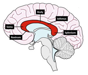 bât sản thể chai