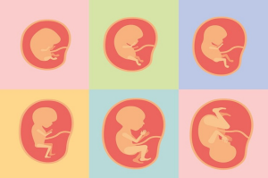 Dị tật tai bẩm sinh là nhóm bất thường xuất hiện từ trong bụng mẹ