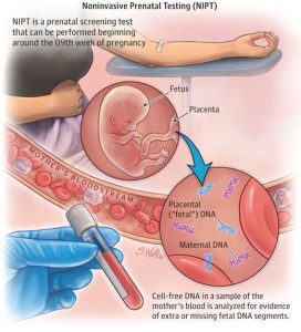NIPT là gì