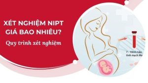 Xét nghiệm nipt giá bao nhiêu