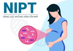 Xét nghiệm nipt
