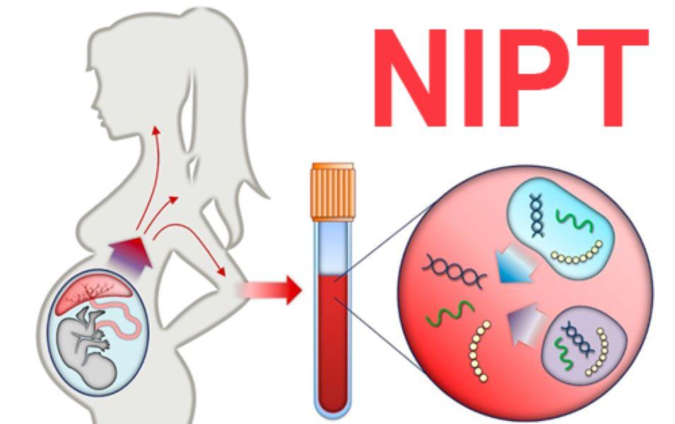 Sơ đồ nguyên lý xét nghiệm NIPT phân tích ADN tự do của thai trong máu mẹ