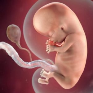 Thoát vị rốn thai nhi