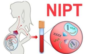 Xét nghiệm nipt biết được những gì