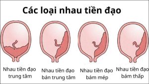 nhau tiền đạo bán trung tâm