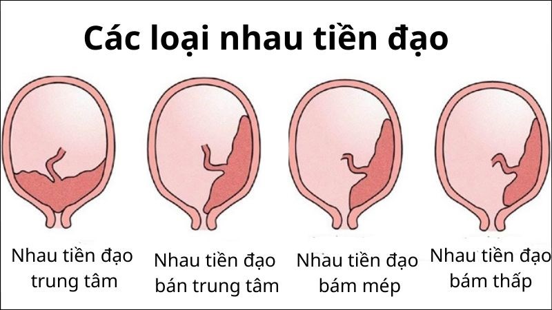 nhau tiền đạo bán trung tâm