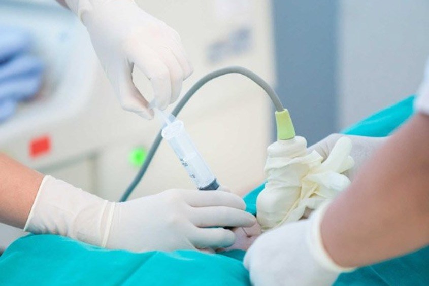 Hình ảnh chọc ối