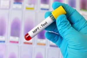 Hình ảnh mẫu mấu NIPT