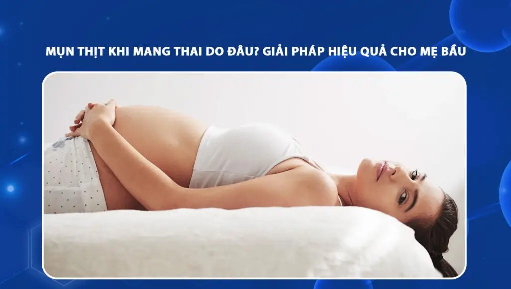 Mụn thịt khi mang thai