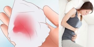 Trễ kinh nhưng không có dấu hiệu mang thai