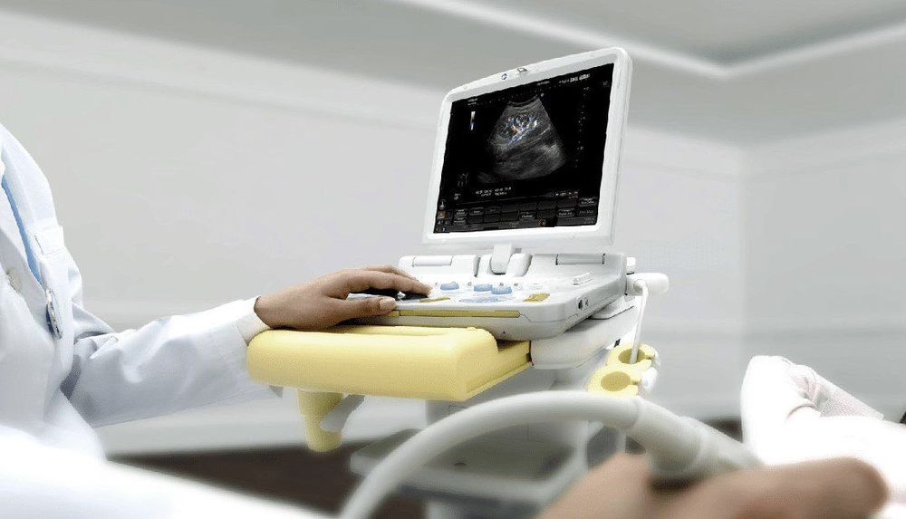 Que thử thai 2 vạch 1 đậm 1 mờ