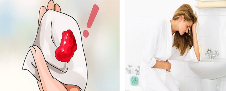 dấu hiệu mang thai ngoài tử cung tuần đầu