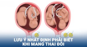 Mang thai đôi cần biết gì