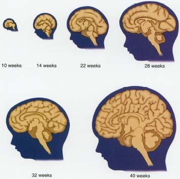 Bất thường hố sau có liên quan bất thường vỏ não không