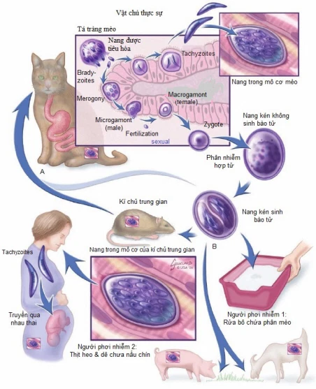 Toxoplasmosis