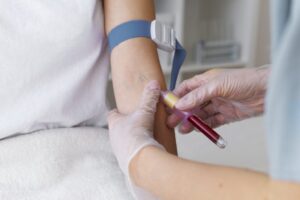 siêu âm lại giãn não thất