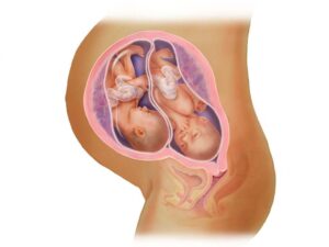 khả năng mang thai đôi có cao không
