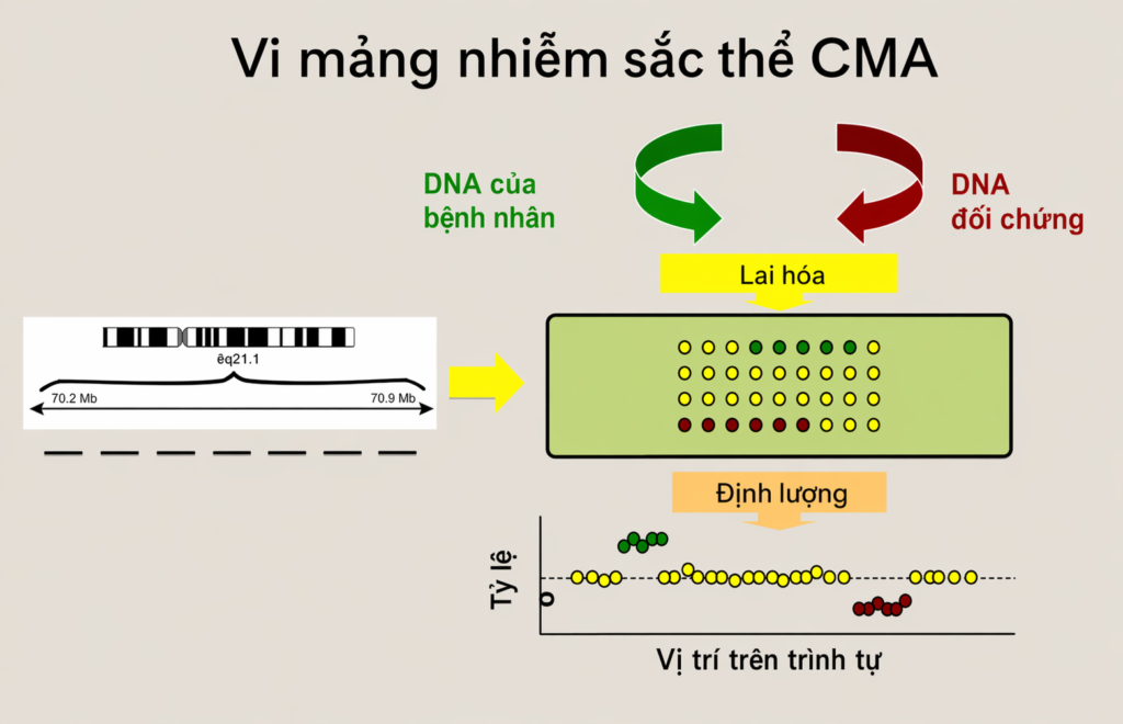 microarray hay exome trong giãn não thất