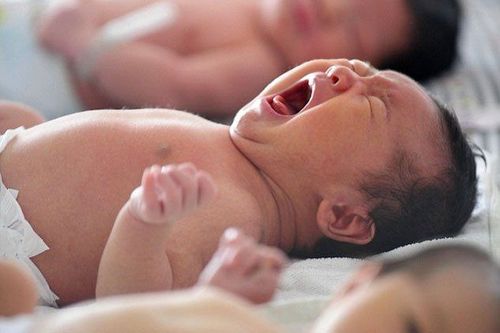 phì đại nửa bán cầu não
