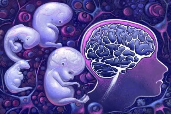 Đa vi cuộn não thai nhi