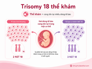 Trisomy 18 thể khảm với một số tế bào bình thường và một số tế bào có thêm nhiễm sắc thể 18