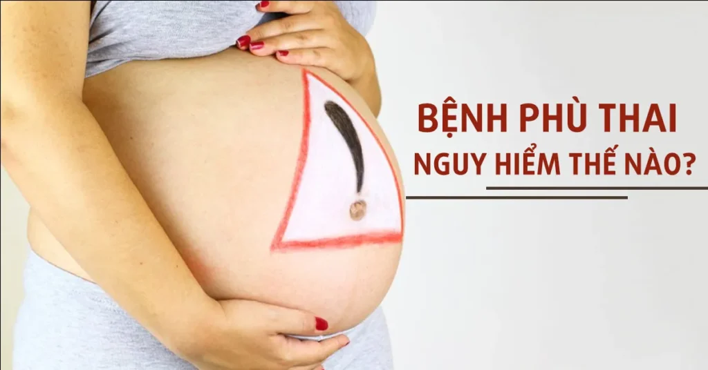 Phù thai là gì