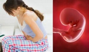 Sảy thai liên tiếp là gì