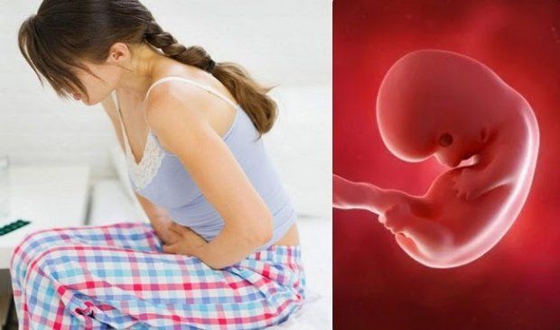 Sảy thai liên tiếp là gì