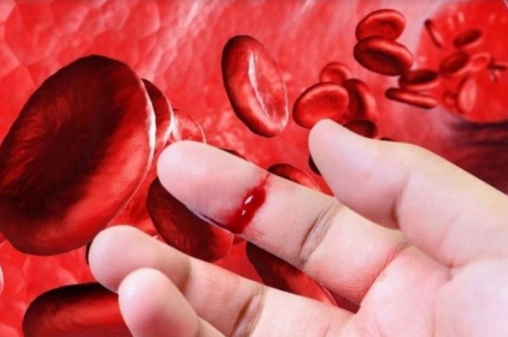 Tăng đông máu di truyền có gây sẩy thai liên tiếp không