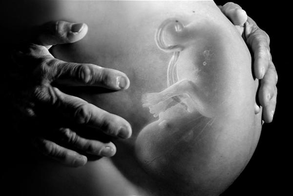 Thai chậm tăng trưởng và tiền sản giật
