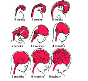 THIỂU SẢN CẦU NÃO