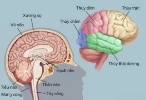 Bất thường hố sau có liên quan bất thường vỏ não không