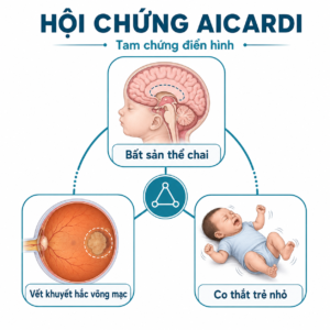 hội chứng Aicardi với tam chứng điển hình gồm bất sản thể chai, tổn thương võng mạc và co giật ở trẻ nhỏ