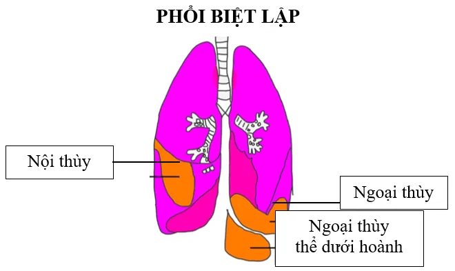 Phổi biệt lập là gì?