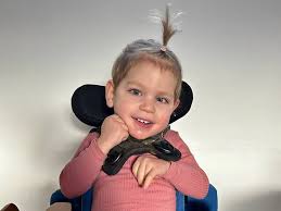 pontocerebellar hypoplasia