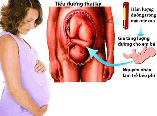 tiểu đường thai kỳ