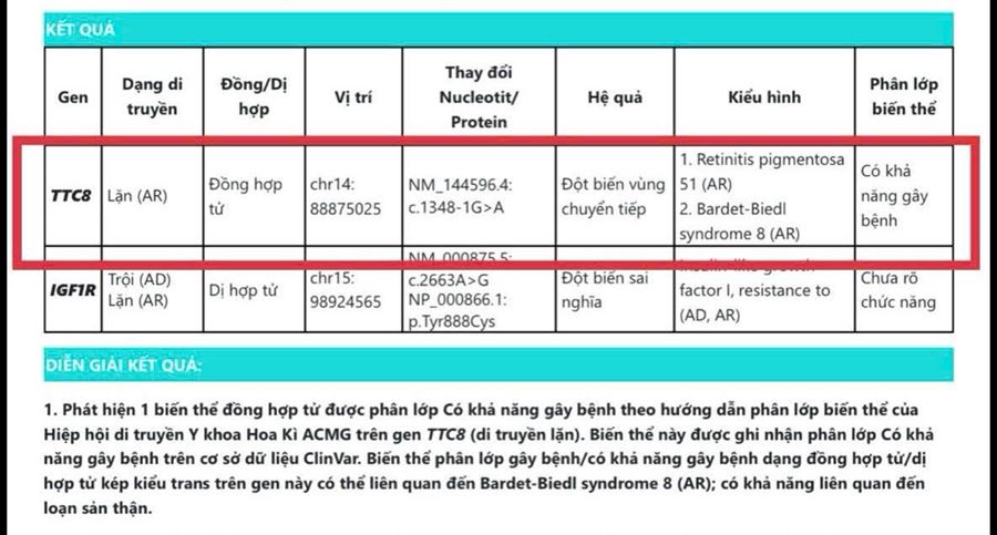 Kết quả xét nghiệm di truyền sau chọc ối ghi nhận biến thể TTC8 liên quan bệnh lý lông chuyển